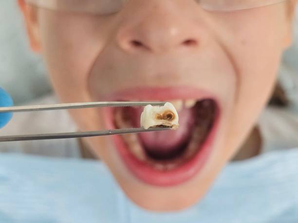 Best Urgent Care for Lost Fillings or Crowns in Bayard, NM